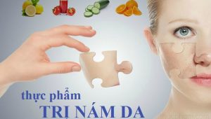 Thực phẩm trị nám da